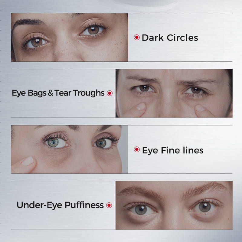 Patchs pour les yeux contre le - Eye Pad Collagen avis et prix