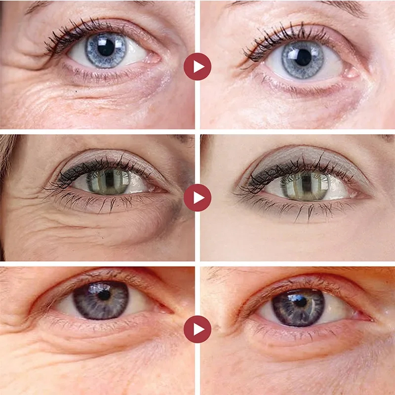 Patchs anti-rides pour les yeu - Eye Pad Collagen avis et prix